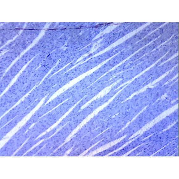 Caja de preparaciones 25 unidades