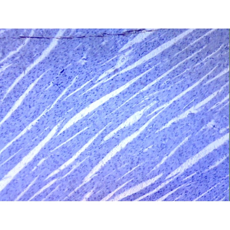 Caja de preparaciones 100 unidades Caja de preparaciones 100 unidades