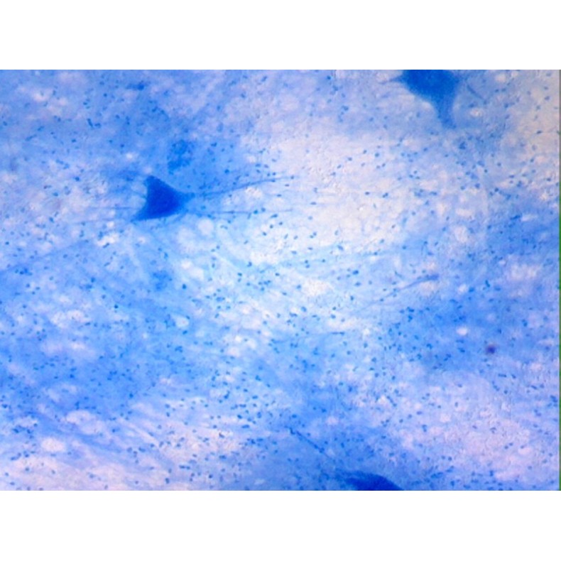 Caja de preparaciones 100 unidades Caja de preparaciones 100 unidades