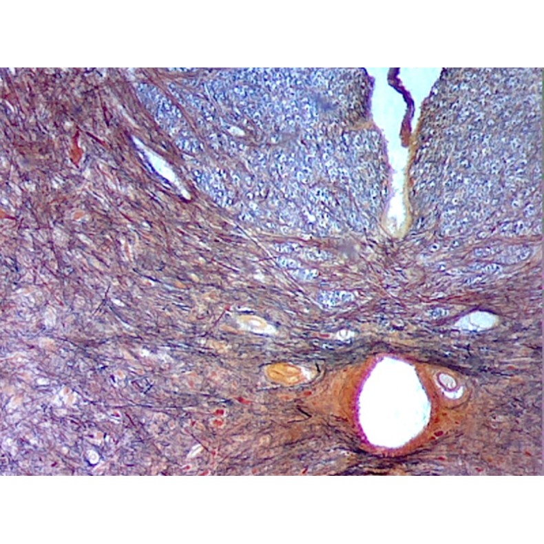 Caja de preparaciones 100 unidades Caja de preparaciones 100 unidades